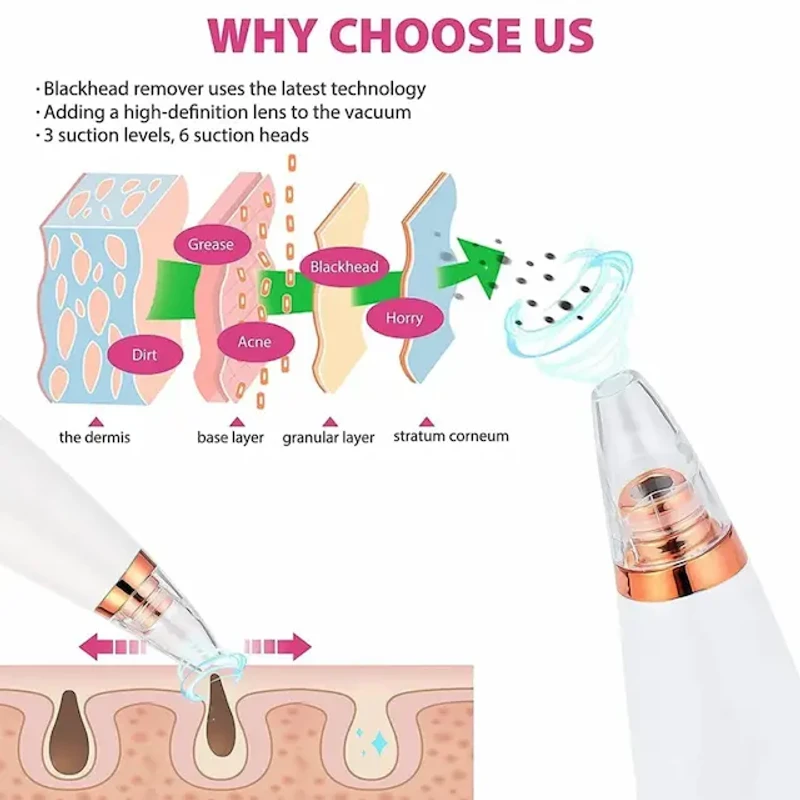 6 in 1 Multi-function Blackhead Remover Tools | Electric Derma suction Machine - Image 9