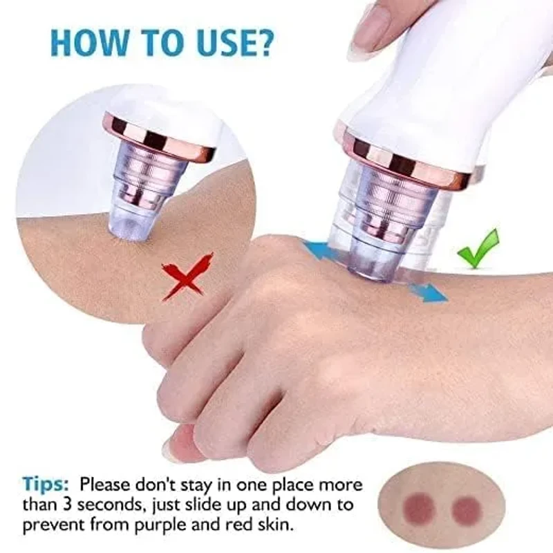 6 in 1 Multi-function Blackhead Remover Tools | Electric Derma suction Machine - Image 6