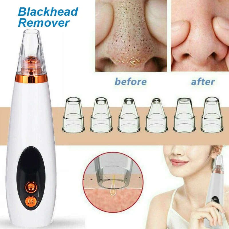 Blackhead Remover Extractor 6 Suction Head Beauty Machine For Skin Care - Image 5