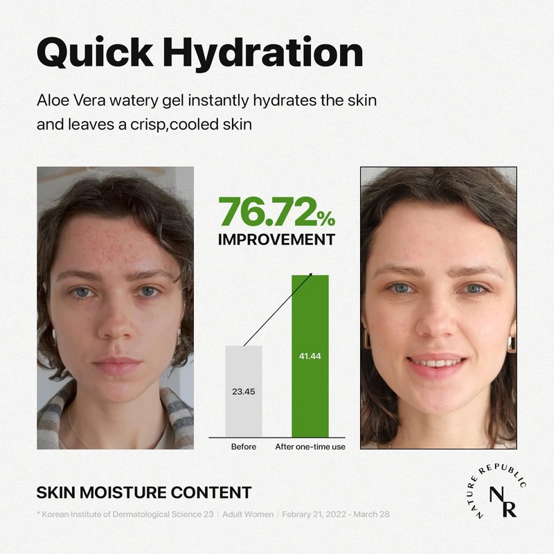 Nature Republic's 92% Soothing & Moisture Aloe Vera Gel (300ml) - Image 5