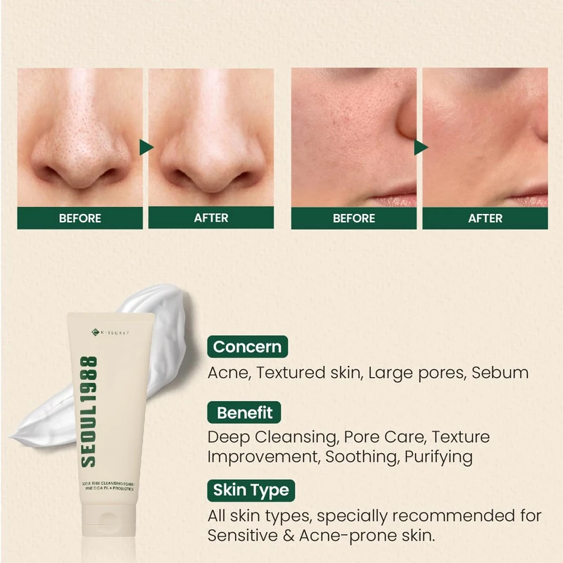 KSECRET SEOUL 1988 Cleansing Foam : Pine Cica 1% + Probiotics (150ml) - Image 3