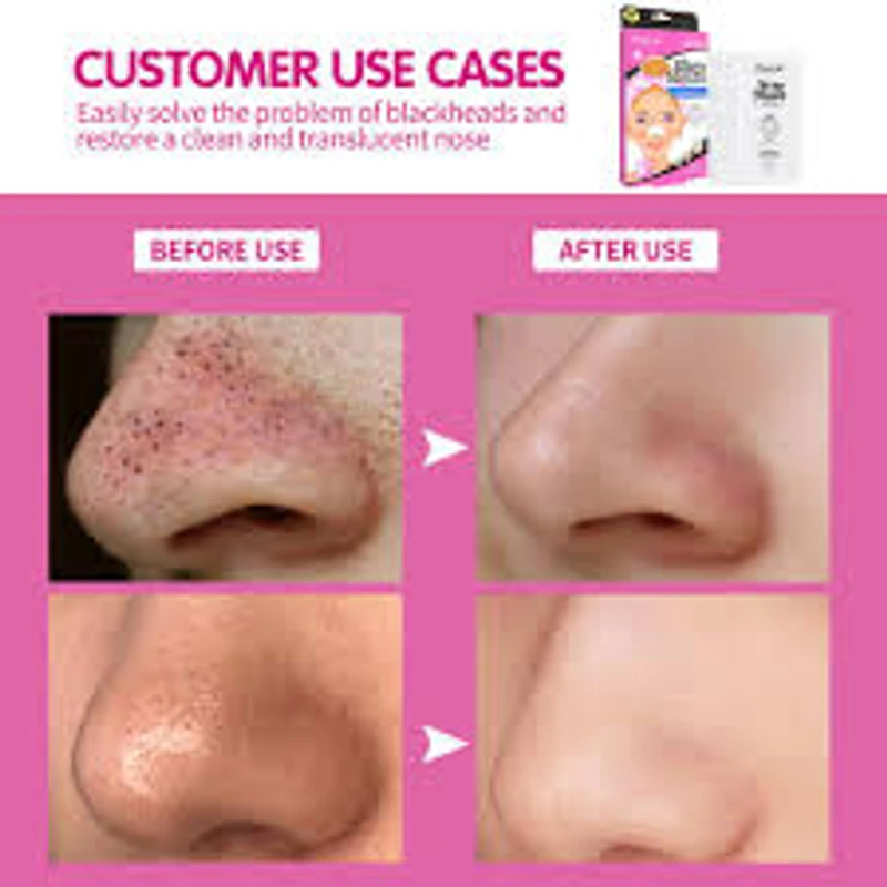 Disunie nose masks Salicylic acid (10pcs) - Image 7