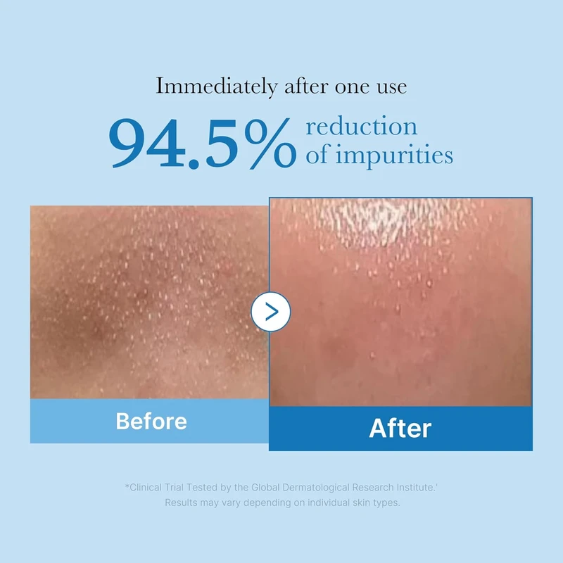 Medicube Zero Pore Blackhead Deep Cleansing Oil (205ml) - Image 4