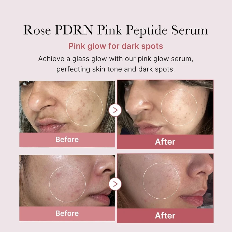 Medicube PDRN Pink Peptide Serum - Image 3