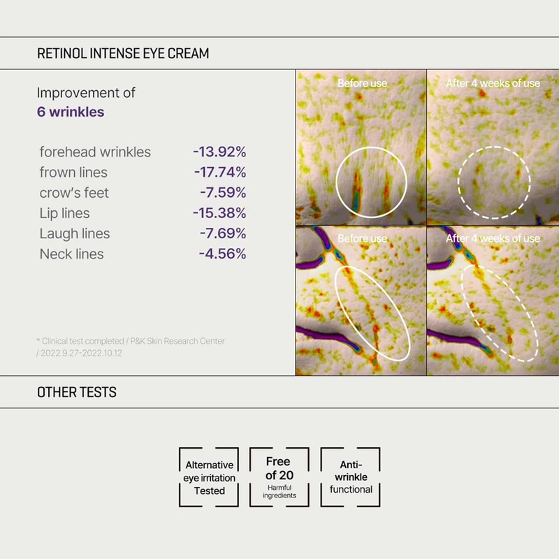 Some By Mi Retinol Intense Trial Kit - Image 6