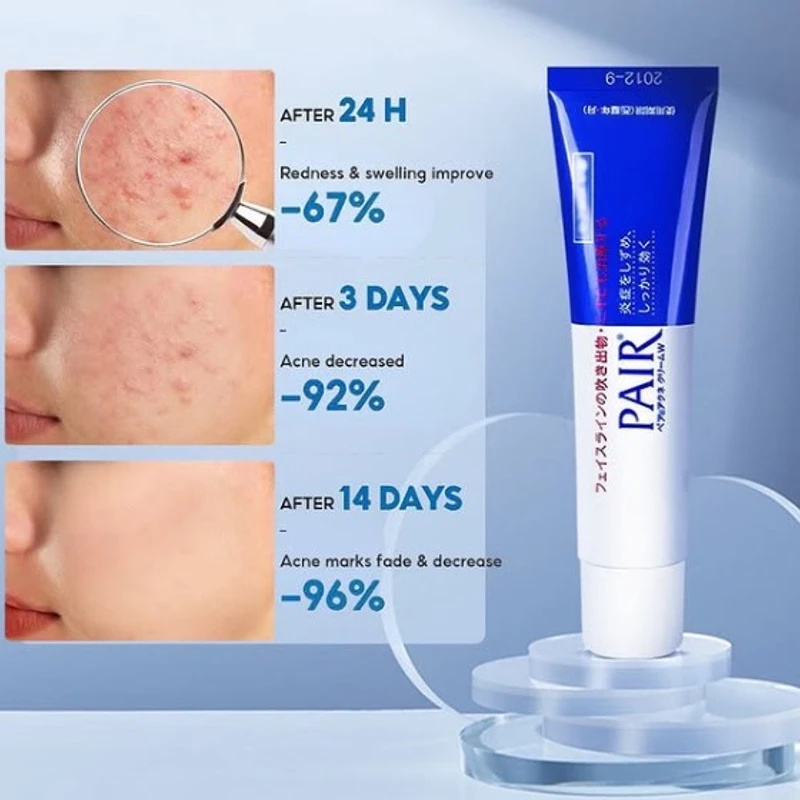 Lion Pair Medicated Acne Care Cream 14gm - Image 3