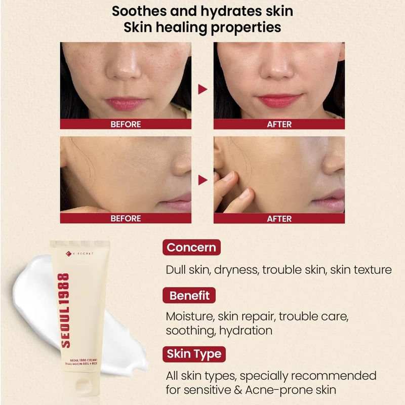 K-SECRET SEOUL 1988 Cream : Snail Mucin 93% + Rice (100ml) - Image 4