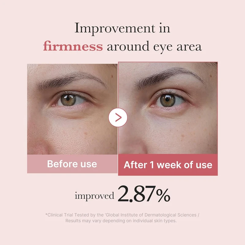 Medicube Salmon DNA PDRN Pink Peptide Eye Serum - Image 3