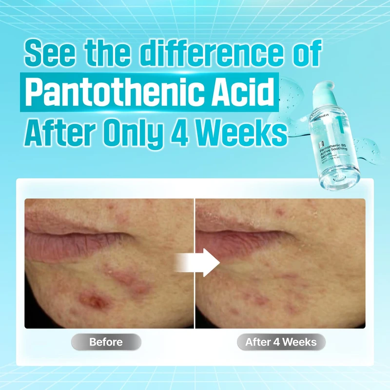 Numbuzin No. 1 Pantothenic B5 Active Soothing Serum - Image 3