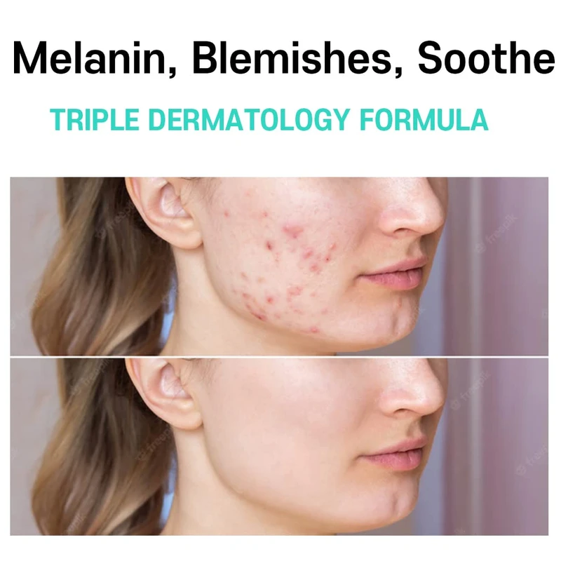 CARE:NEL Anti-Melasma Cica Cream