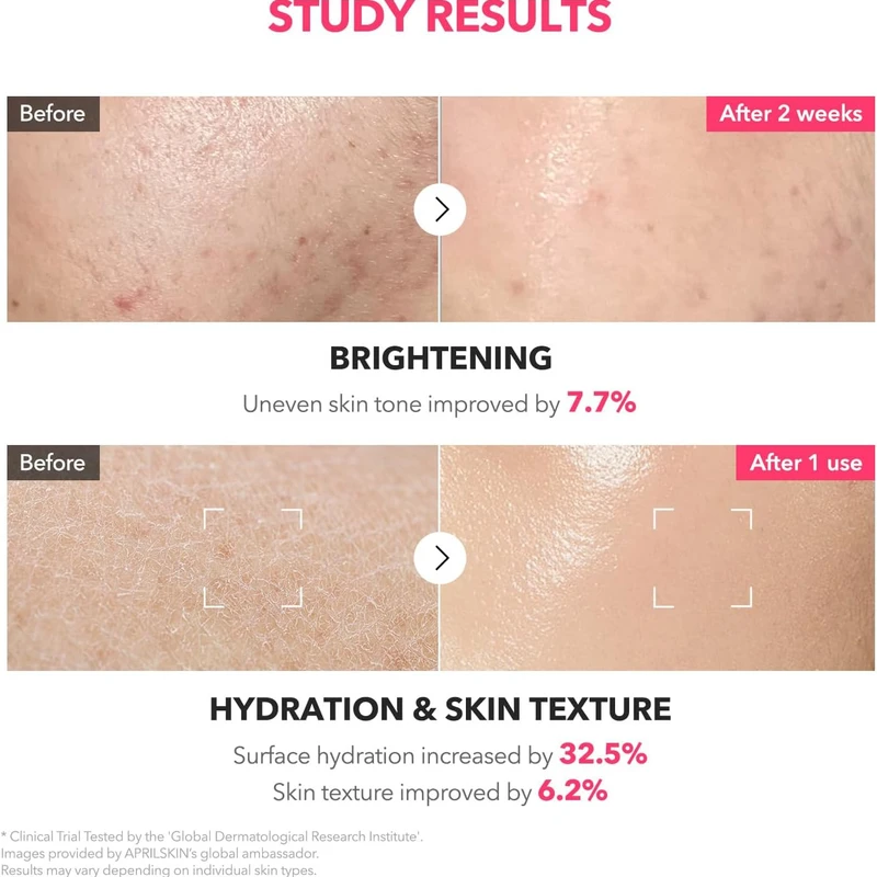 APRILSKIN TXA Niacinamide 99 Milky Toner (150ml) - Image 5