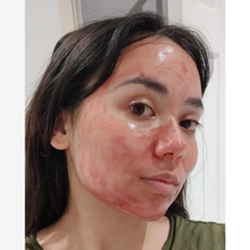 The Ordinary AHA 30% + BHA 2% Peeling Solution - Image 7