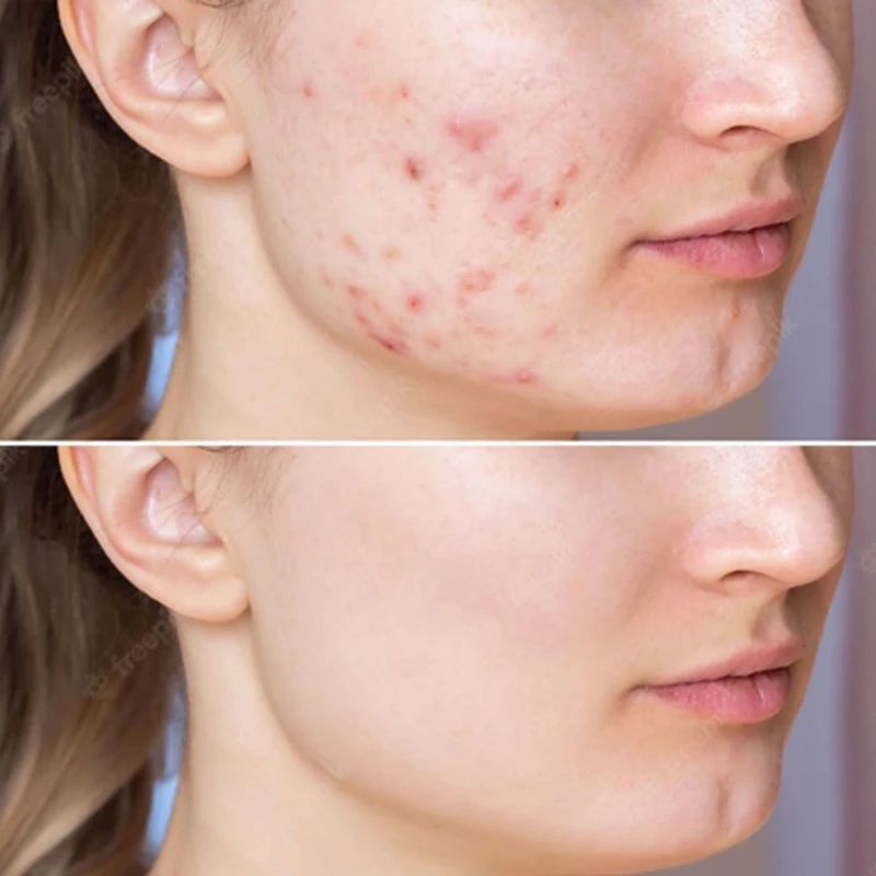 Carenel Anti-Melasma Cica Treatment Toner (155ml)