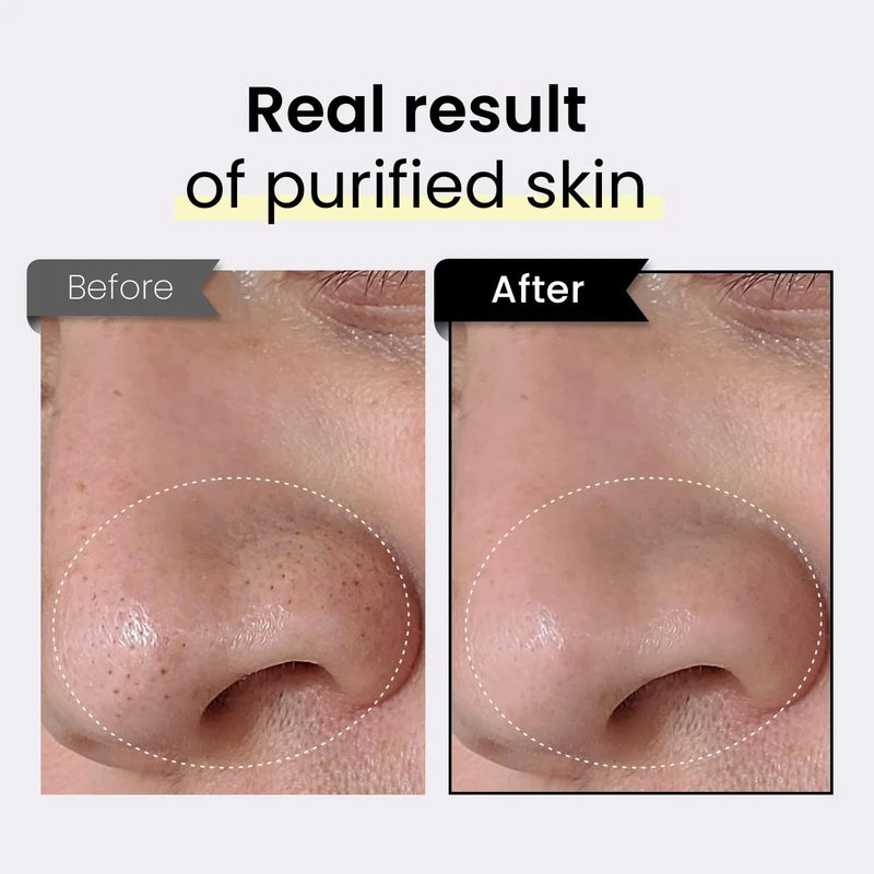 Coxir Black Rice TXA Pore Purifying Mask (50ml) - Image 7