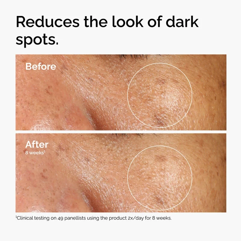 The Ordinary Alpha Arbutin 2% + HA serum - Image 4