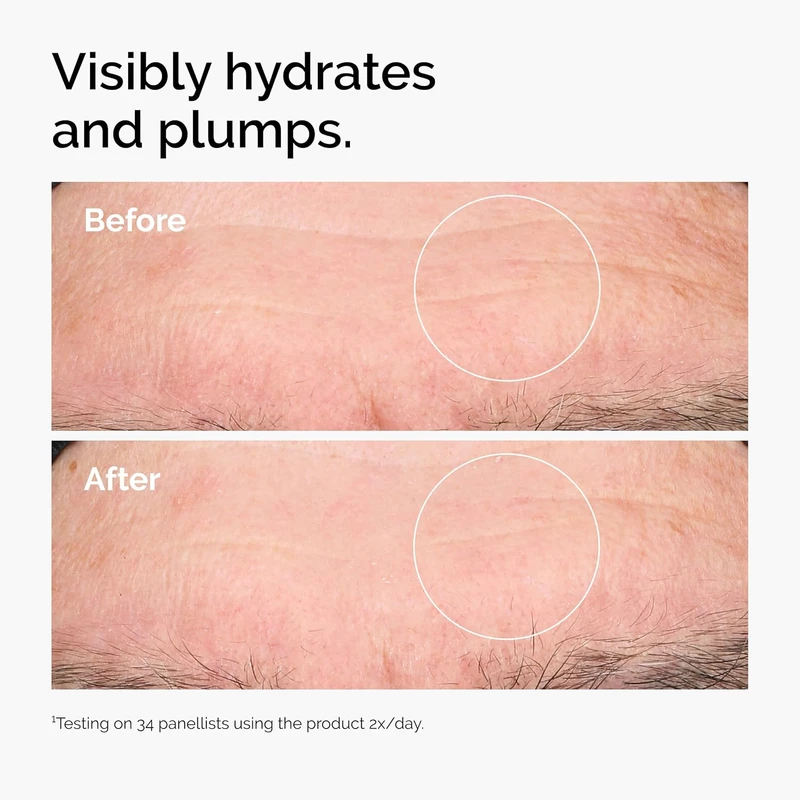 The Ordinary Hyaluronic Acid 2% + B5 (with Ceramides) serum - Image 5