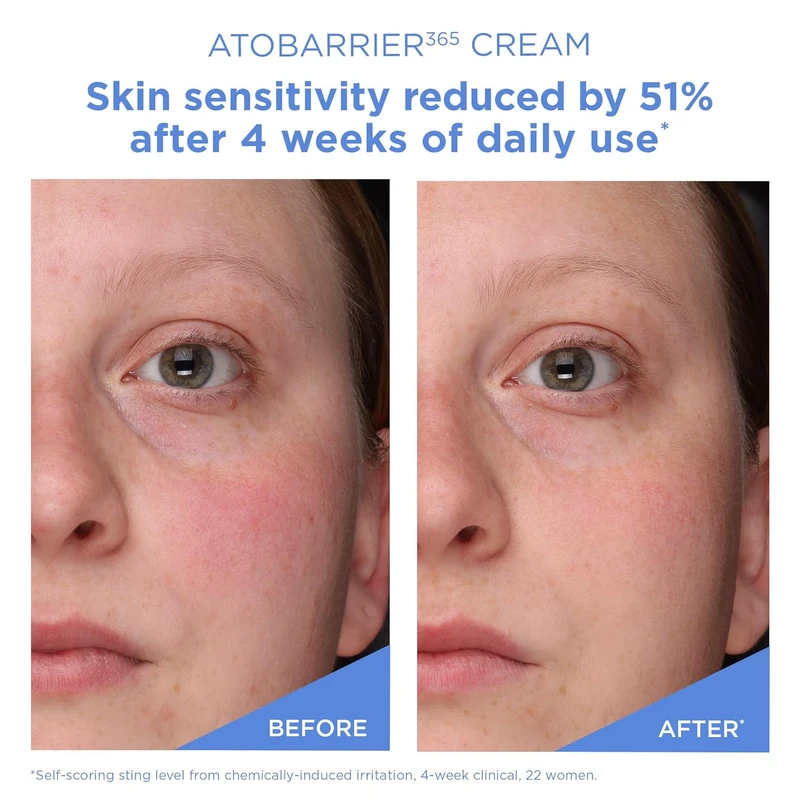 Aestura Atobarrier 365 Cream (30ml) - Image 7