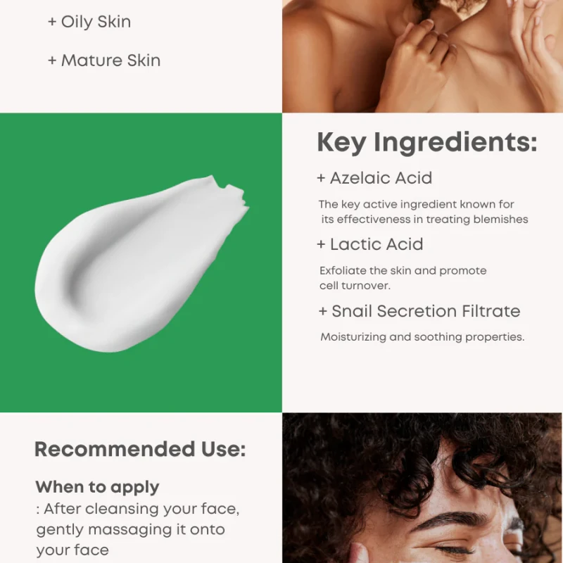 Nineless A-Control Azelaic Acid Cream (50ml) - Image 5