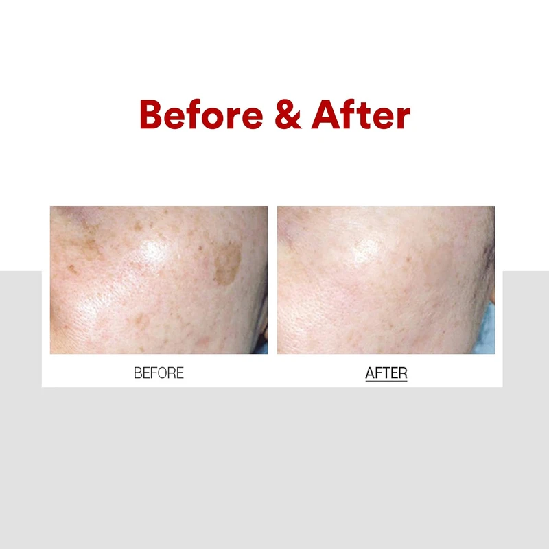 MediPeel Melanon X Cream (30ml) - Image 7