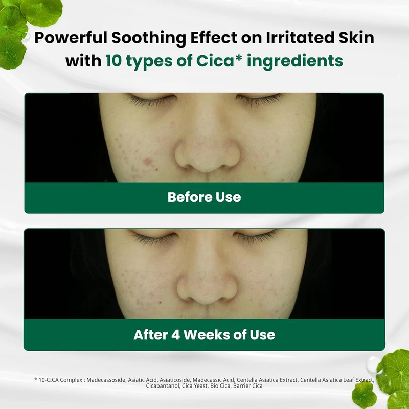 Dr. G R.E.D Blemish Clear Soothing Cream (70ml) - Image 3