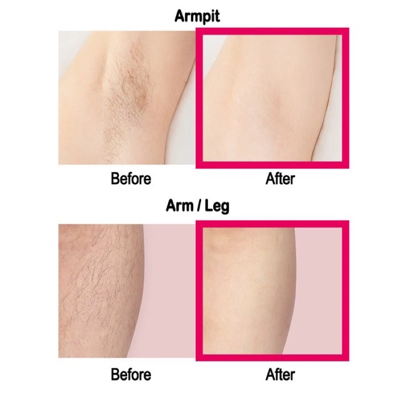 DAISO FreeMo Factory Body Hair Removal Cream Original 80g - Image 6