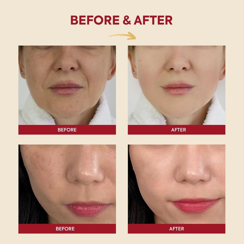 K-SECRET SEOUL 1988 Essence : Snail Mucin 97% + Rice (100ml) - Image 4