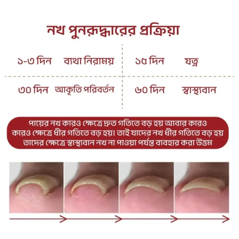 ২ পিছ জার্মান নখ রিপেয়ার অয়েল ২০মিলি - ফুল কোর্স - Image 4