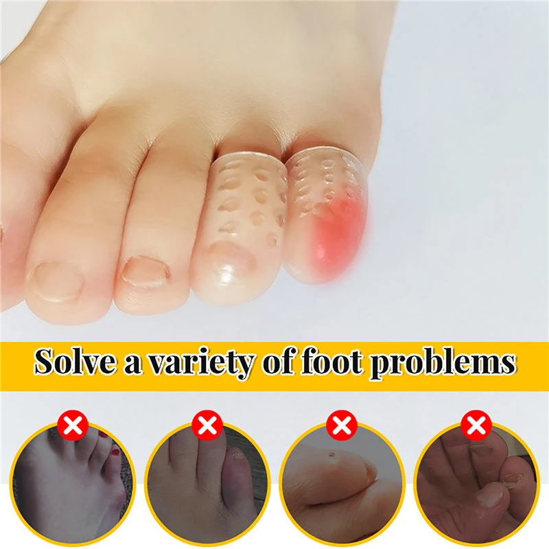 10Pcs Breathable Sleeve Toe Protector Silicone Anti-Friction Toe Caps Prevent Blisters Toe Cover Protector Foot Care - Image 3