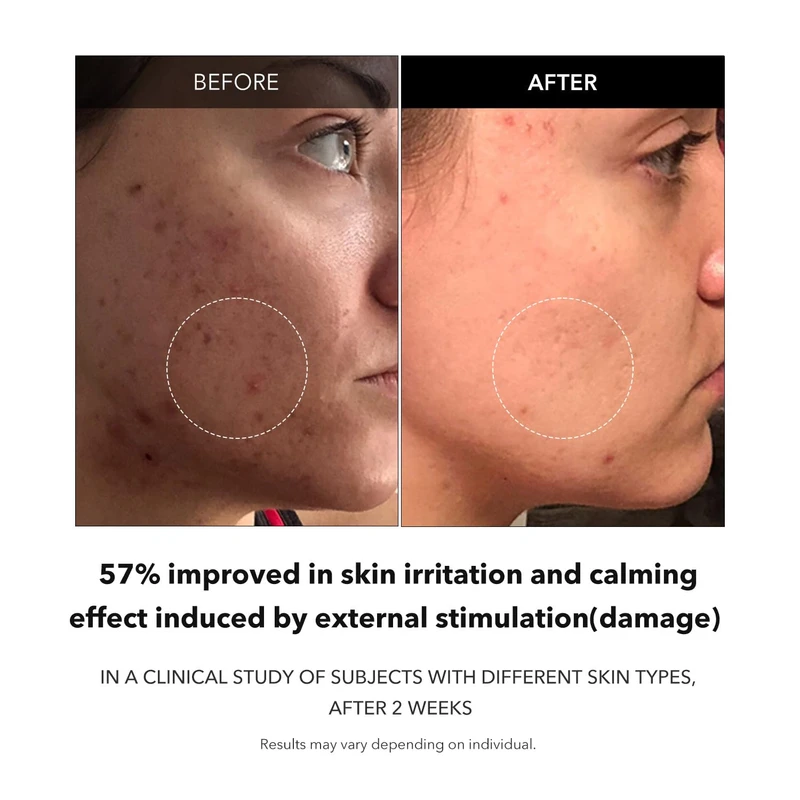 APRILSKIN Carrotene Clarifying Serum (37ml) - Image 3