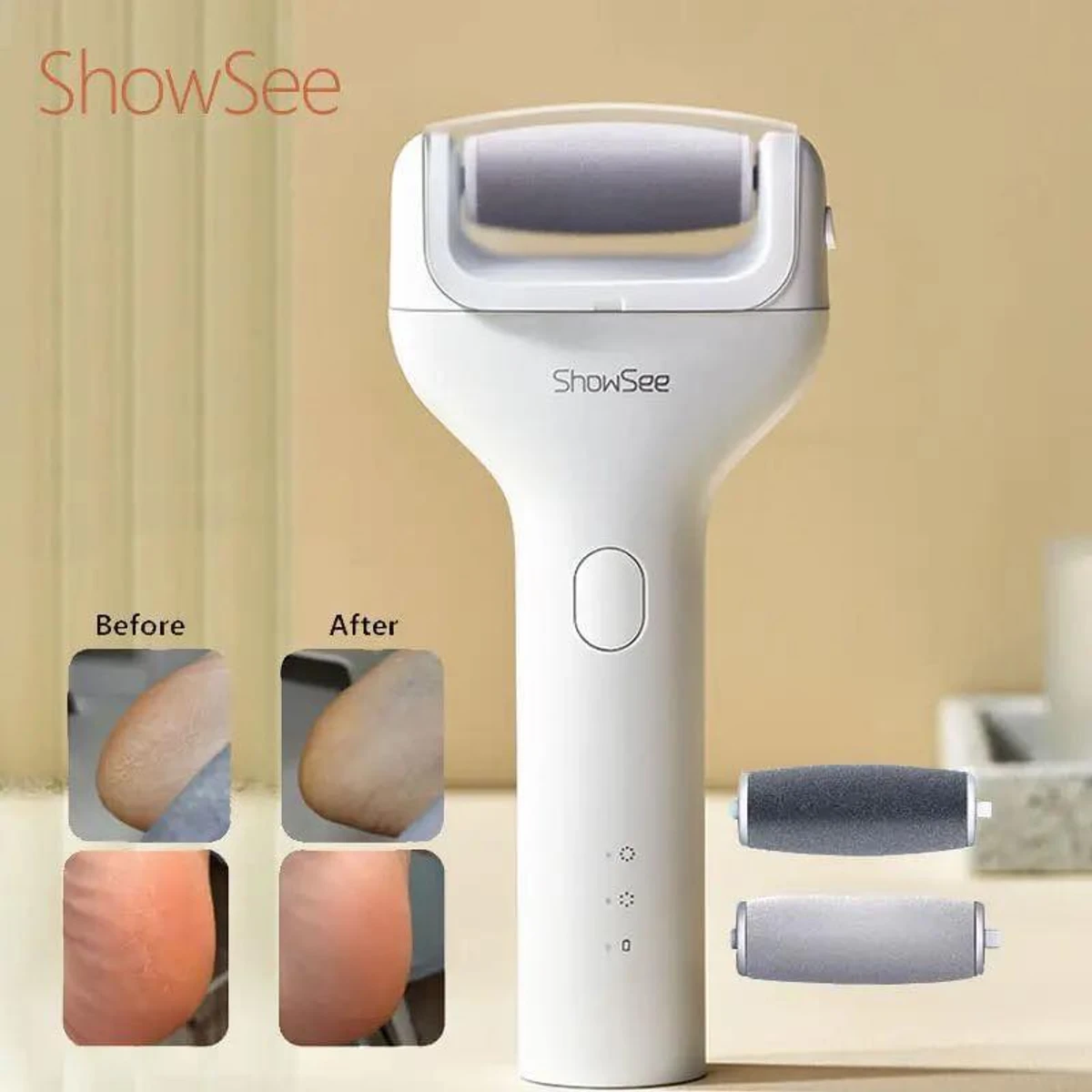 Xiaomi Showsee Electric Foot File Vacuum Callus Remover - Image 1