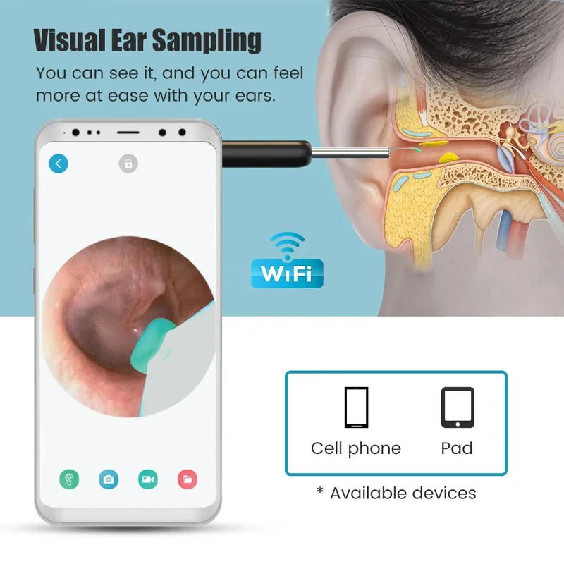 Wireless Visual Earpick