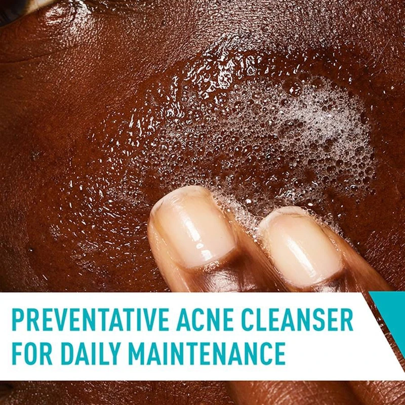 CeraVe Acne Control Cleanser with 2% Salicylic Acid – 473ml - Image 4
