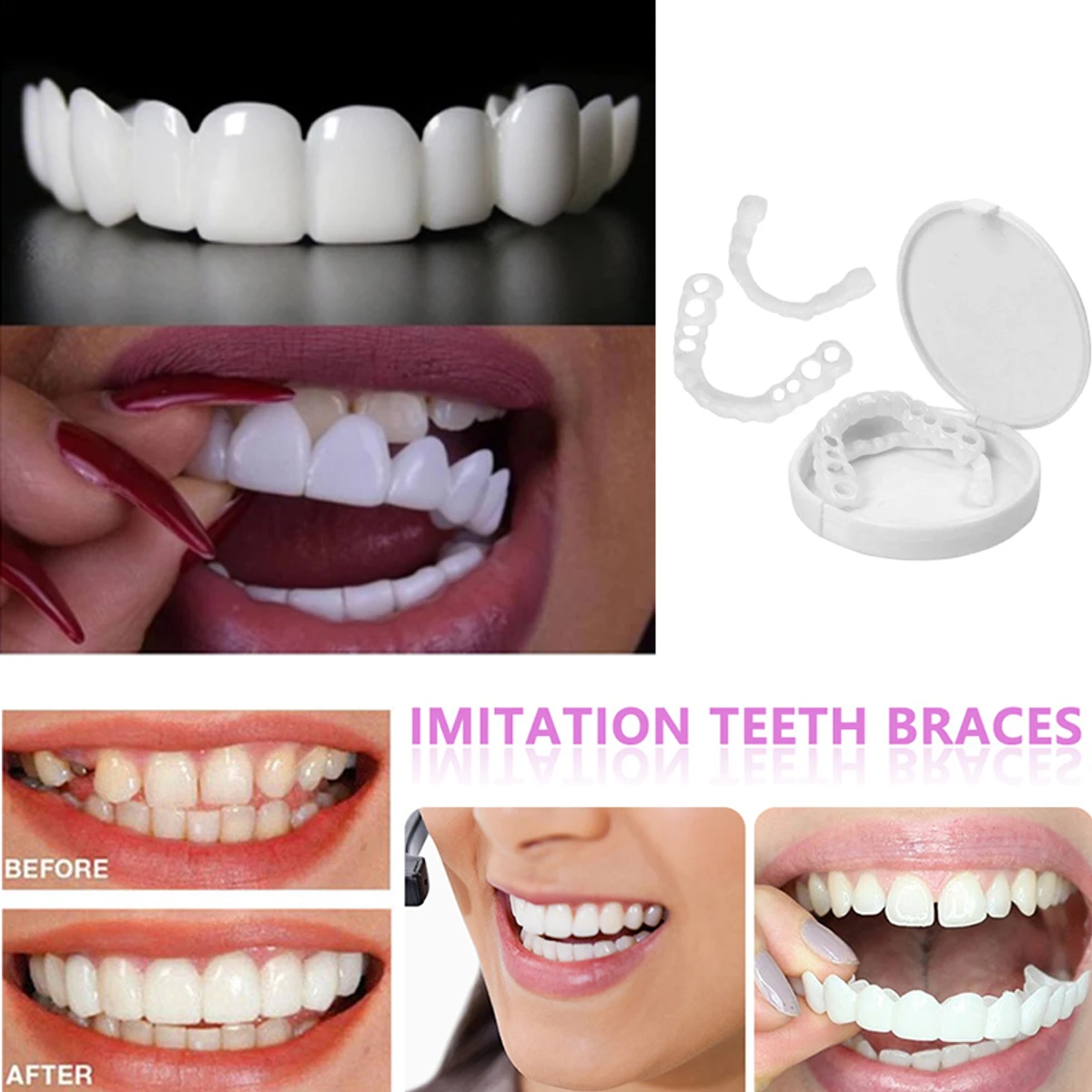 1 Pair Teeth ( 2 pcs) Veneers Whitening Dentures Imitation Braces Temporary False Teeth Cover Perfect Smile Comfortable Fit Denture Kit - Image 1