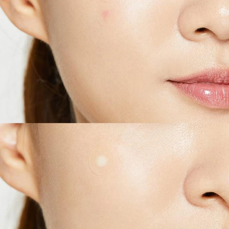 Cosrx Acne Pimple Master Patch 24's Pack - Image 6